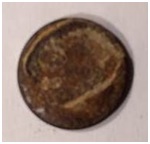 Zdjęcie 9. Ciało obce usunięte ręcznie z odbytnicy – skorodowany krążek metalowy – najprawdopodobniej moneta o nominale 5 gr.